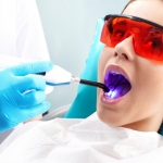 Dental Filling