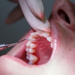 Periodontics