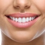 closeup of smile with white teeth