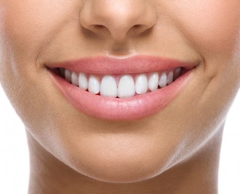 closeup of smile with white teeth