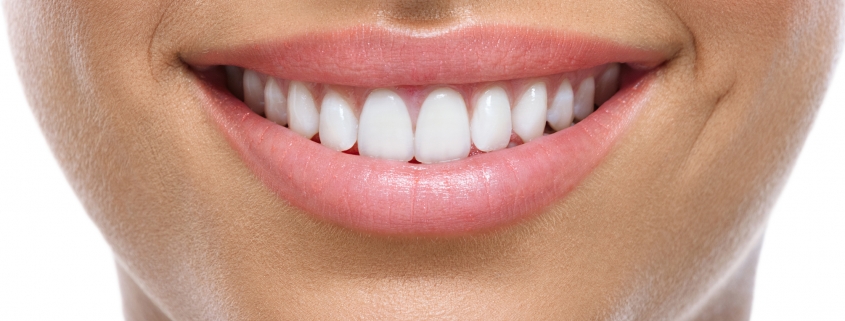 closeup of smile with white teeth