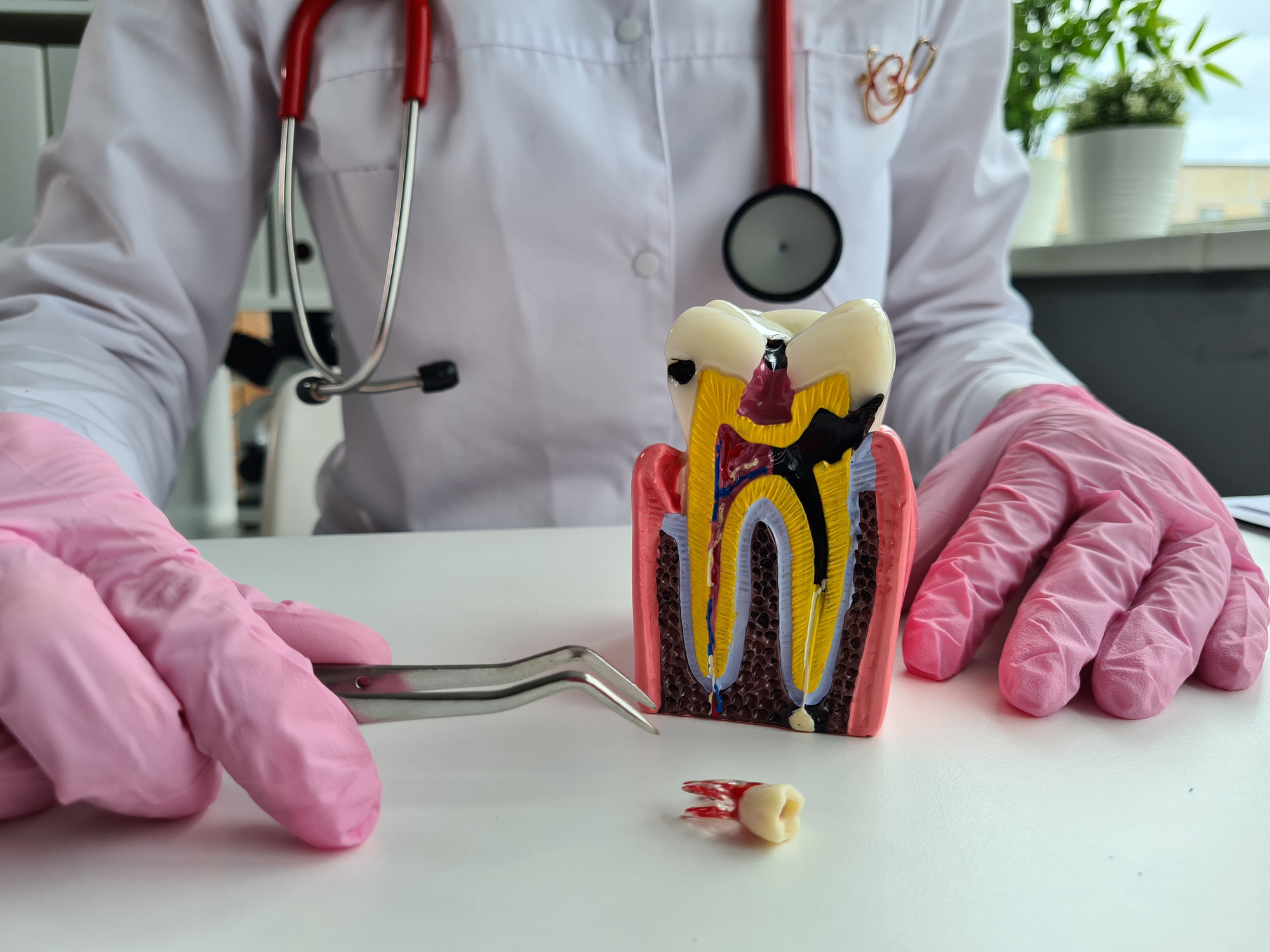 Does my tooth need nerve extraction? Dentist in Newbury Park