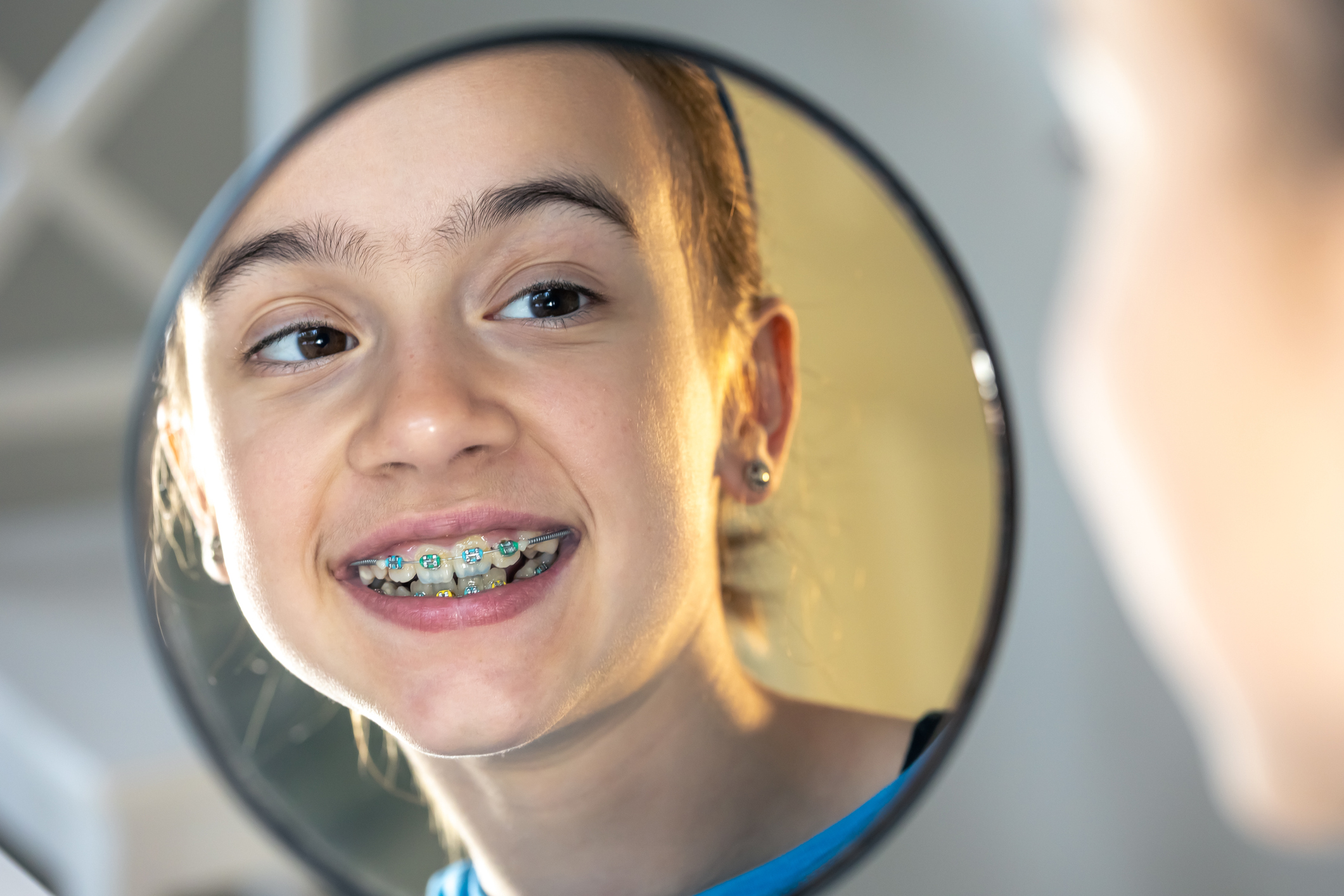 The Optimal Age for Orthodontic Treatment Dentist in Newbury Park