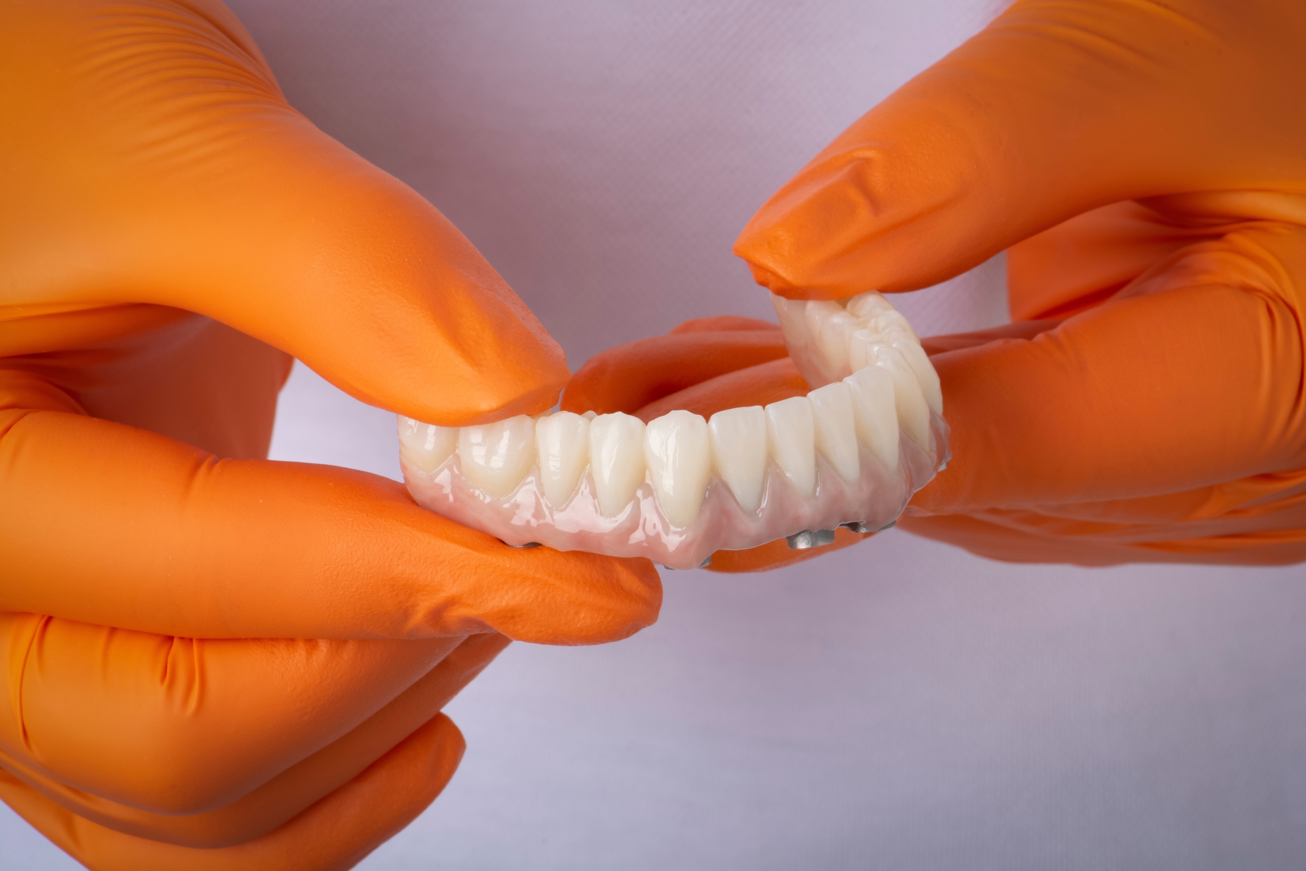 Patient consultation for full arch dental implants at Newbury Smiles Dentistry