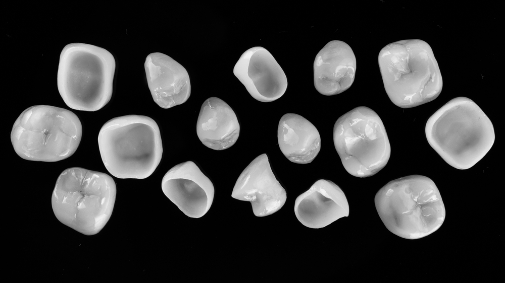 dental crowns in newbury park | dental crowns in thousand oaks